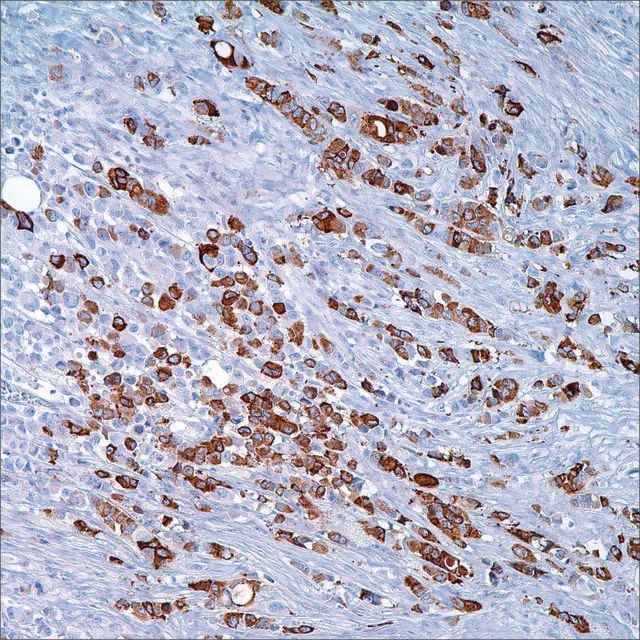 Mammaglobin Cocktail (304-1A5 &31A5) Mouse/Rabbit Monoclonal Antibodies