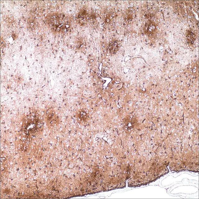 Glial Fibrillary Acidic Protein (EP672Y) Rabbit Monoclonal Primary Antibody