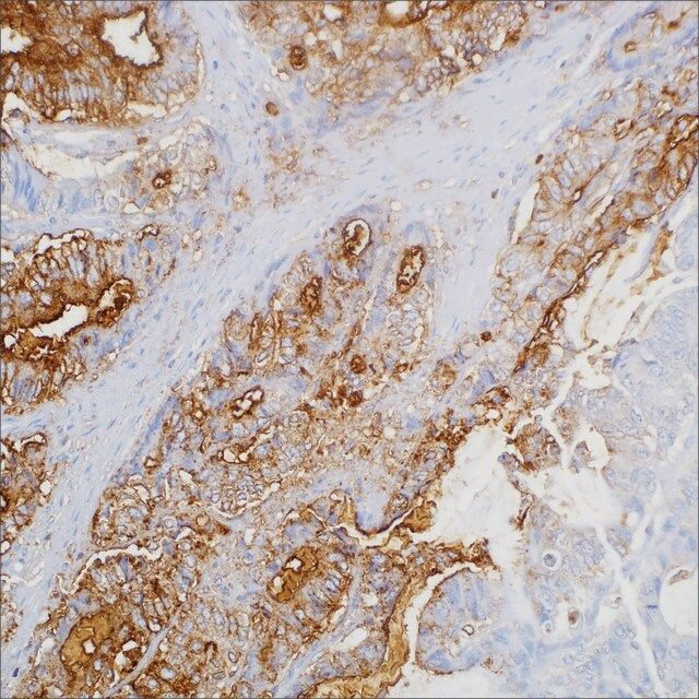 CA19-9 (121SLE) Mouse Monoclonal Antibody