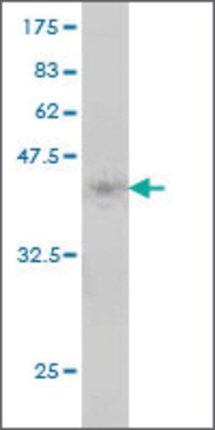 Monoclonal Anti-MTRR antibody produced in mouse