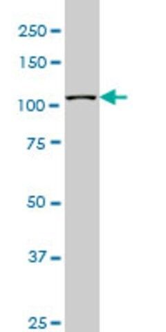 Monoclonal Anti-MUSK antibody produced in mouse