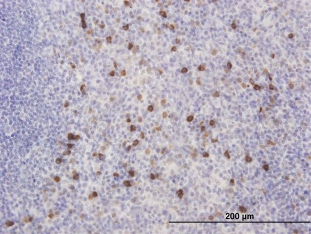 Monoclonal Anti-KCNIP2 antibody produced in mouse