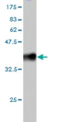 Monoclonal Anti-RNF20 antibody produced in mouse