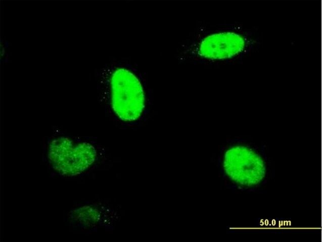 Monoclonal Anti-RNUT1 antibody produced in mouse