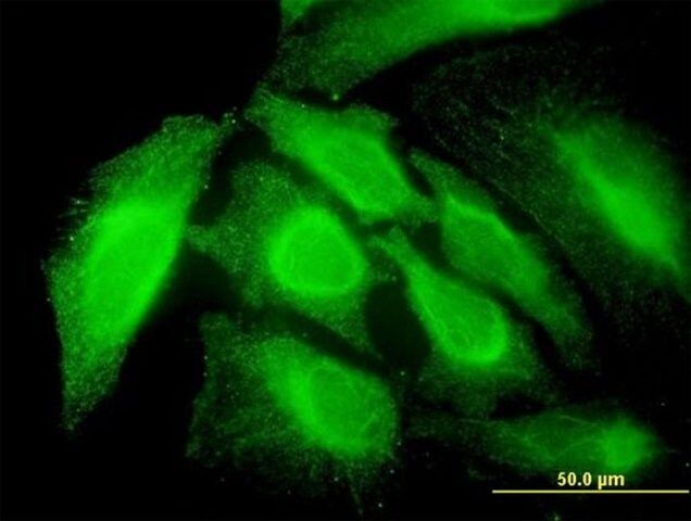 Monoclonal Anti-RNF14 antibody produced in mouse