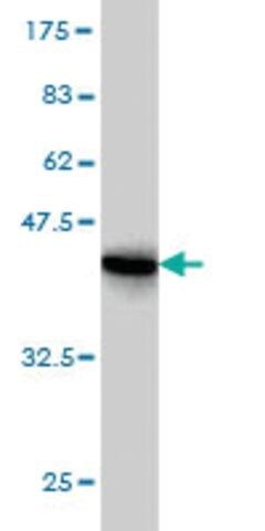 Monoclonal Anti-RPS19 antibody produced in mouse