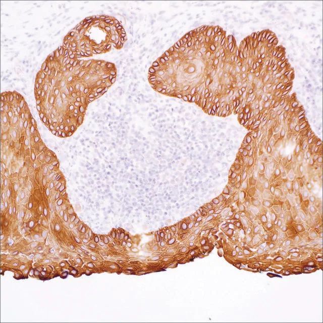 Cytokeratin 17 (EP98) Rabbit Monoclonal Primary Antibody