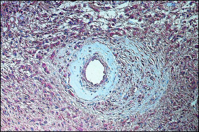 Anti-Fibroblast Growth Factor-Basic (1-24) antibody produced in rabbit