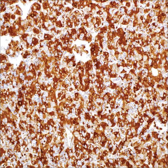 Alpha-Fetoprotein Rabbit Polyclonal Antibody