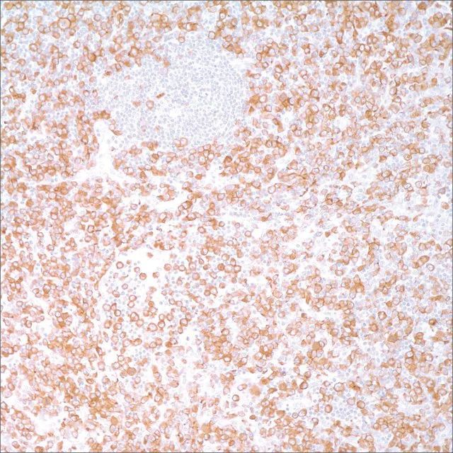 ALK Protein (ALK-1) Mouse Monoclonal Antibody