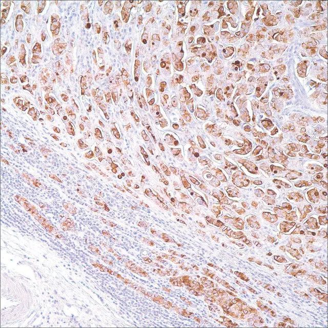 BCA-225 (Cu-18) Mouse Monoclonal Antibody