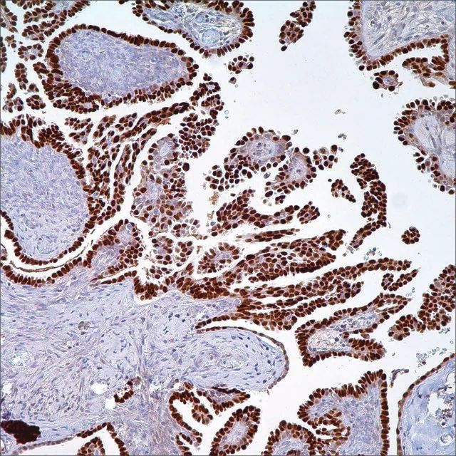 PAX-8 Rabbit Polyclonal Antibody