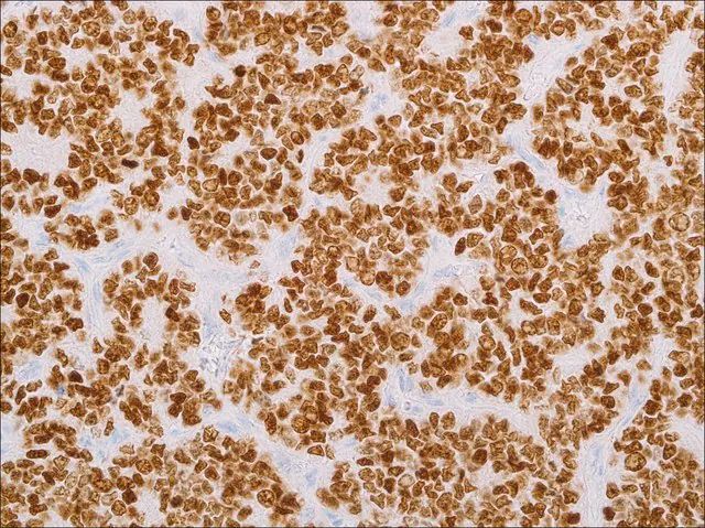 NKX2.2 (EP336) Rabbit Monoclonal Primary Antibody