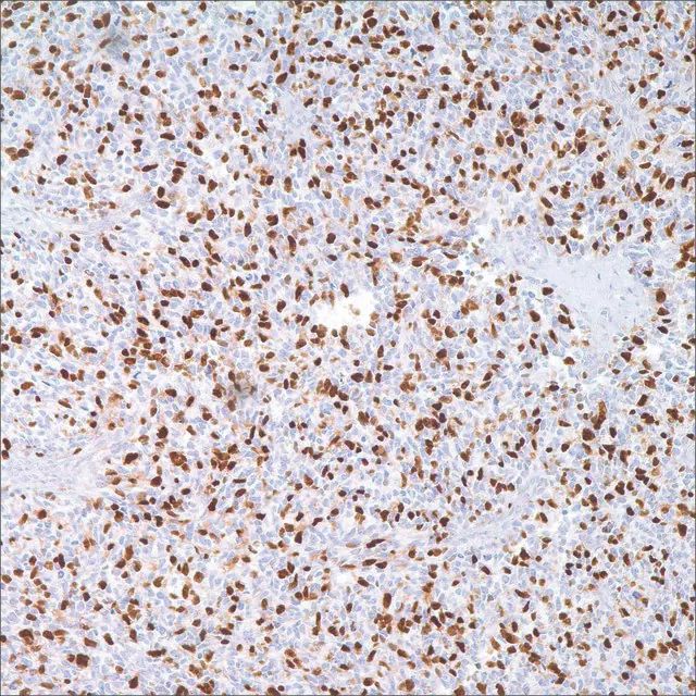 Myogenin (F5D) Mouse Monoclonal Antibody