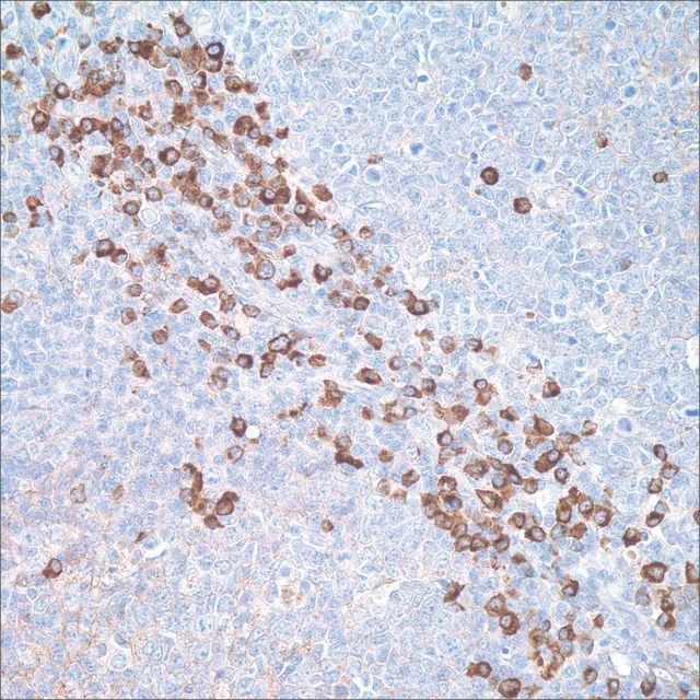 IgG Rabbit Polyclonal Antibody