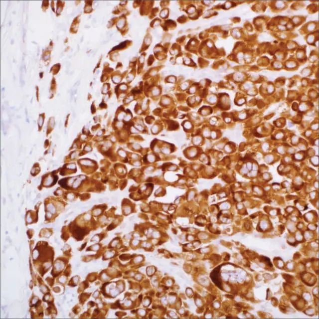 IMP3 (EP286) Rabbit Monoclonal Primary Antibody