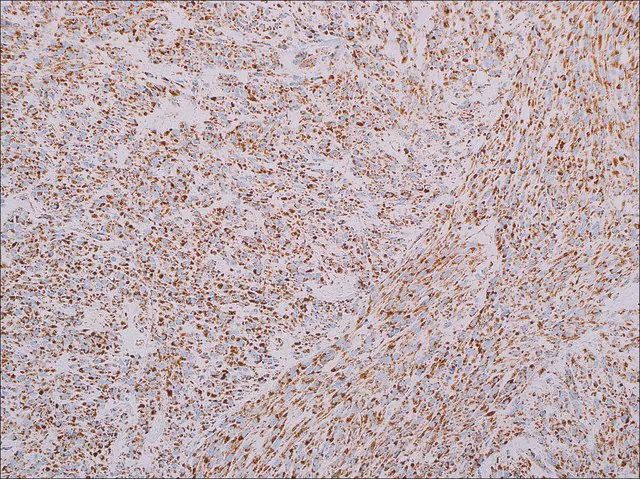 SDHB (EP288) Rabbit Monoclonal Primary Antibody