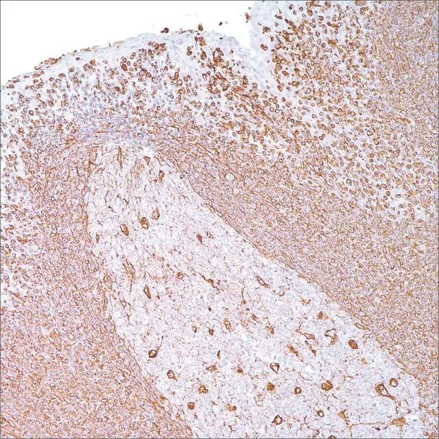 Vimentin (V9) Mouse Monoclonal Antibody