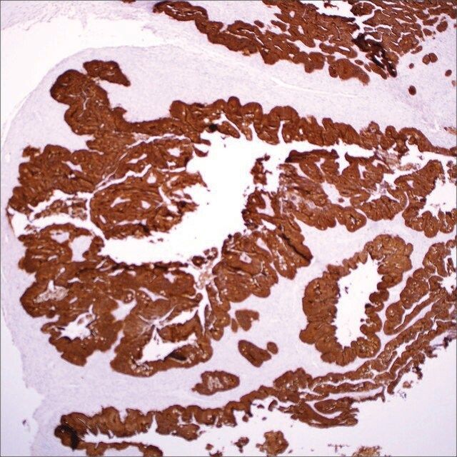 Villin (EP163) Rabbit Monoclonal Primary Antibody