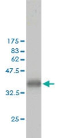 Monoclonal Anti-CKS1B antibody produced in mouse