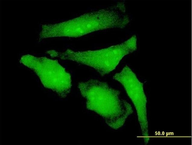 Monoclonal Anti-C20orf18 antibody produced in mouse