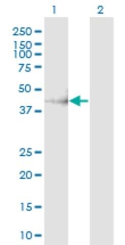 Monoclonal Anti-CHST11 antibody produced in mouse