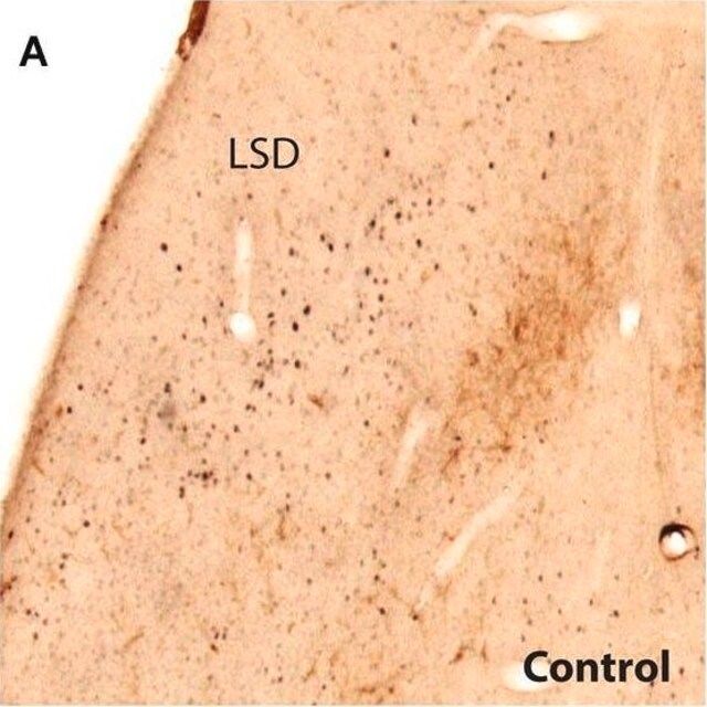 Monoclonal Anti-Tyrosine Hydroxylase antibody produced in mouse