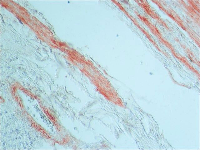 Monoclonal Anti-Tenascin antibody produced in mouse