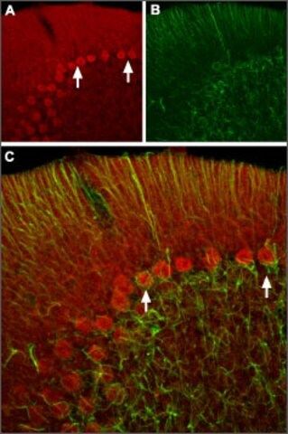 Anti-Hyperpolarization-Activated Cation Channel HCN2 antibody produced in rabbit