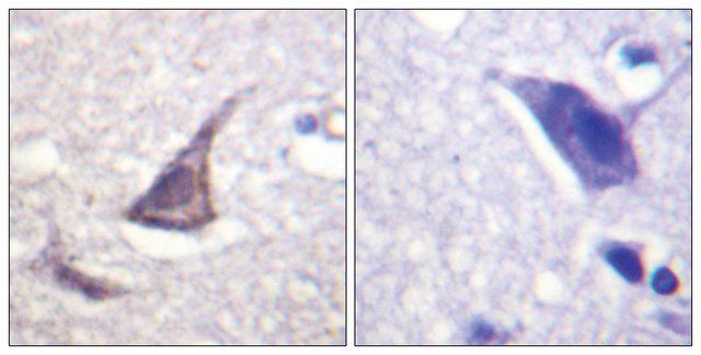 Anti-Calcium Sensing Receptor antibody produced in rabbit