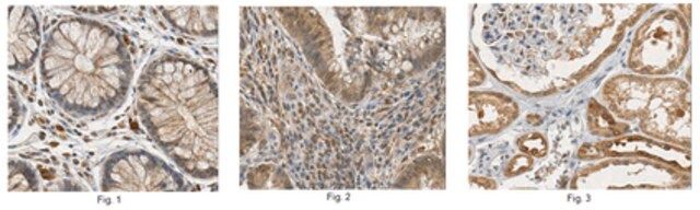 Anti-Corticotropin-Releasing Factor Receptor 2 Antibody