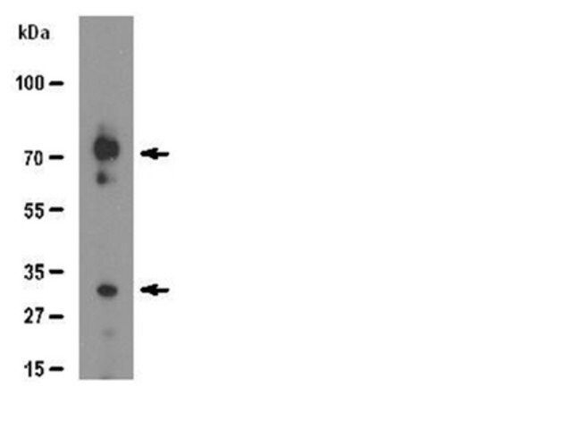 Anti-Syndecan-1 Antibody