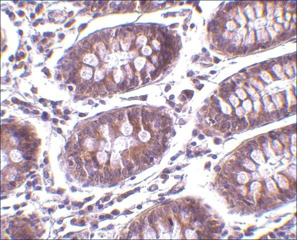 Anti-MICA antibody produced in rabbit