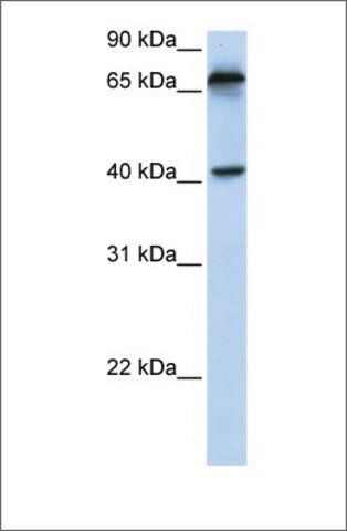 Anti-MICA antibody produced in rabbit