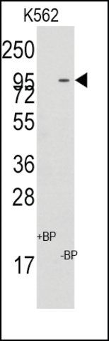 Anti-MIC1 (center) antibody produced in rabbit