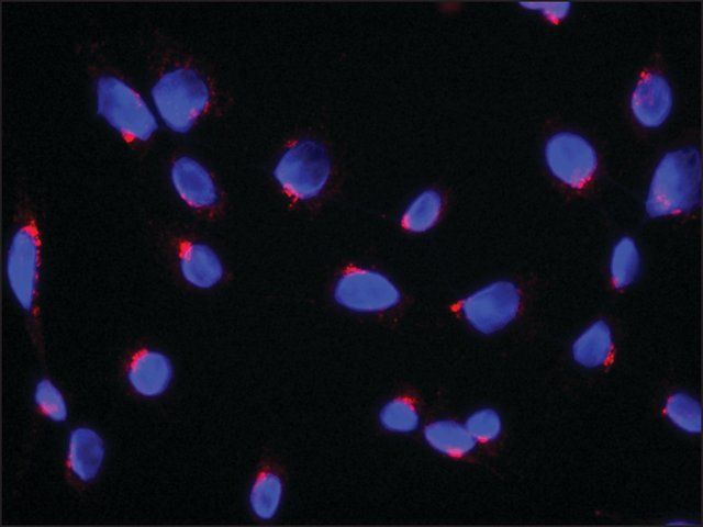 Anti-RER1 antibody produced in rabbit