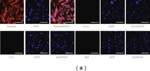 Anti-Nestin Antibody, clone 10C2