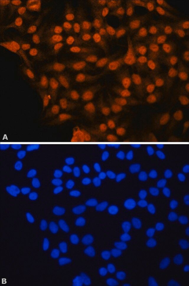 Anti-RUNX1 (N-terminal) antibody produced in rabbit