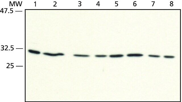 Anti-RACK1 (C-terminal) antibody produced in rabbit