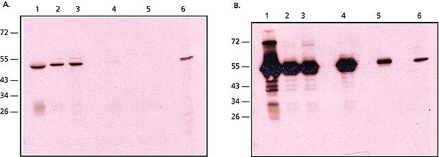 Anti-Rabbit IgG, Native antibody, Mouse monoclonal