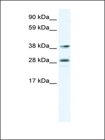 Anti-MEF2B antibody produced in rabbit