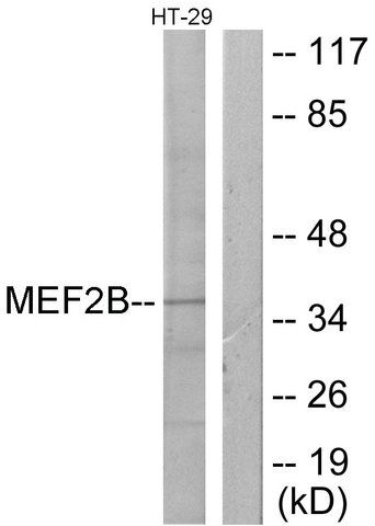 Anti-MEF2B antibody produced in rabbit