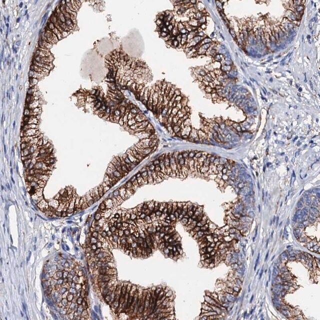 Anti-MED13L antibody produced in rabbit