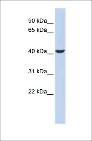 Anti-MEF2B antibody produced in rabbit