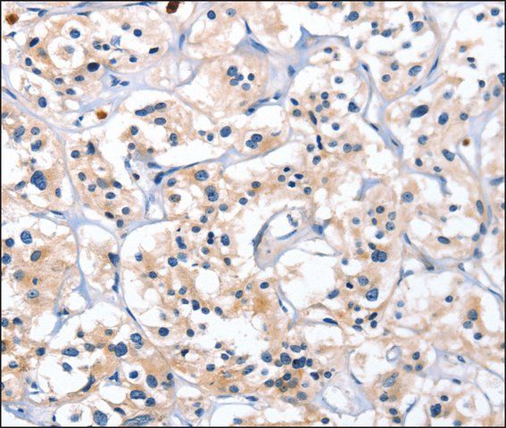 Anti-CATSPER1 antibody produced in rabbit