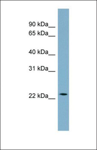 Anti-CCDC25 antibody produced in rabbit