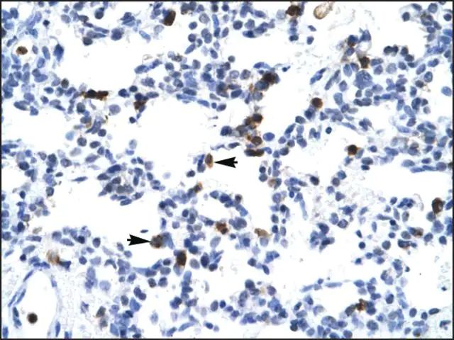 Anti-E2F6 antibody produced in rabbit