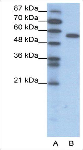 Anti-FOXC2 (AB1) antibody produced in rabbit