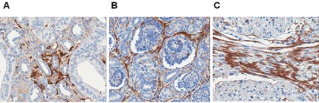 Anti-Laminin-5 Antibody, clone P3E4