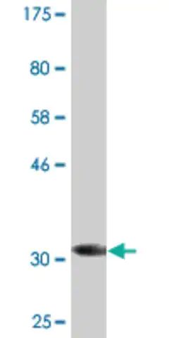 Monoclonal Anti-CIR antibody produced in mouse